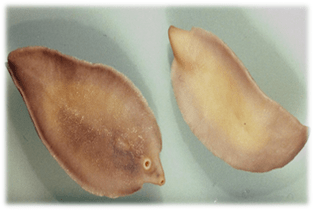 Fasioolosis